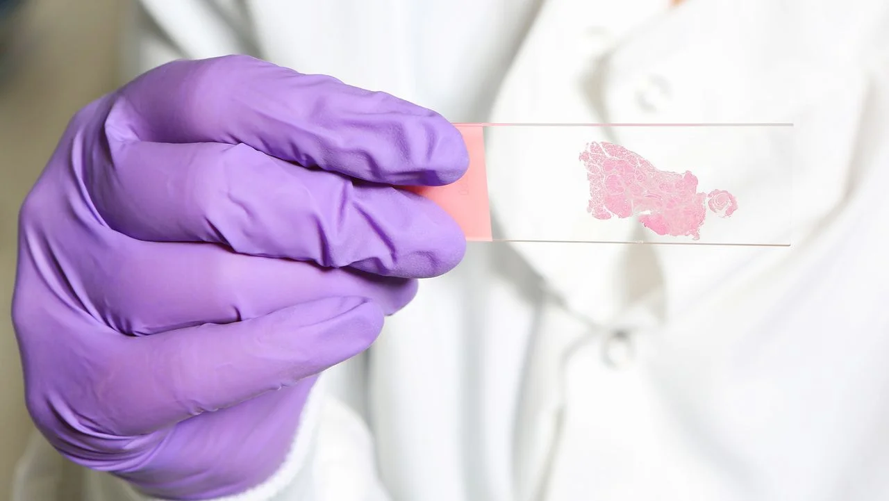 AI Trained to Emulate Human Pathologists Enhances Cancer Detection Accuracy