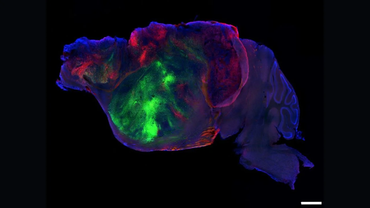 Lab Mice with Human Brain Tissue: A New Perspective on Neurodevelopmental Research