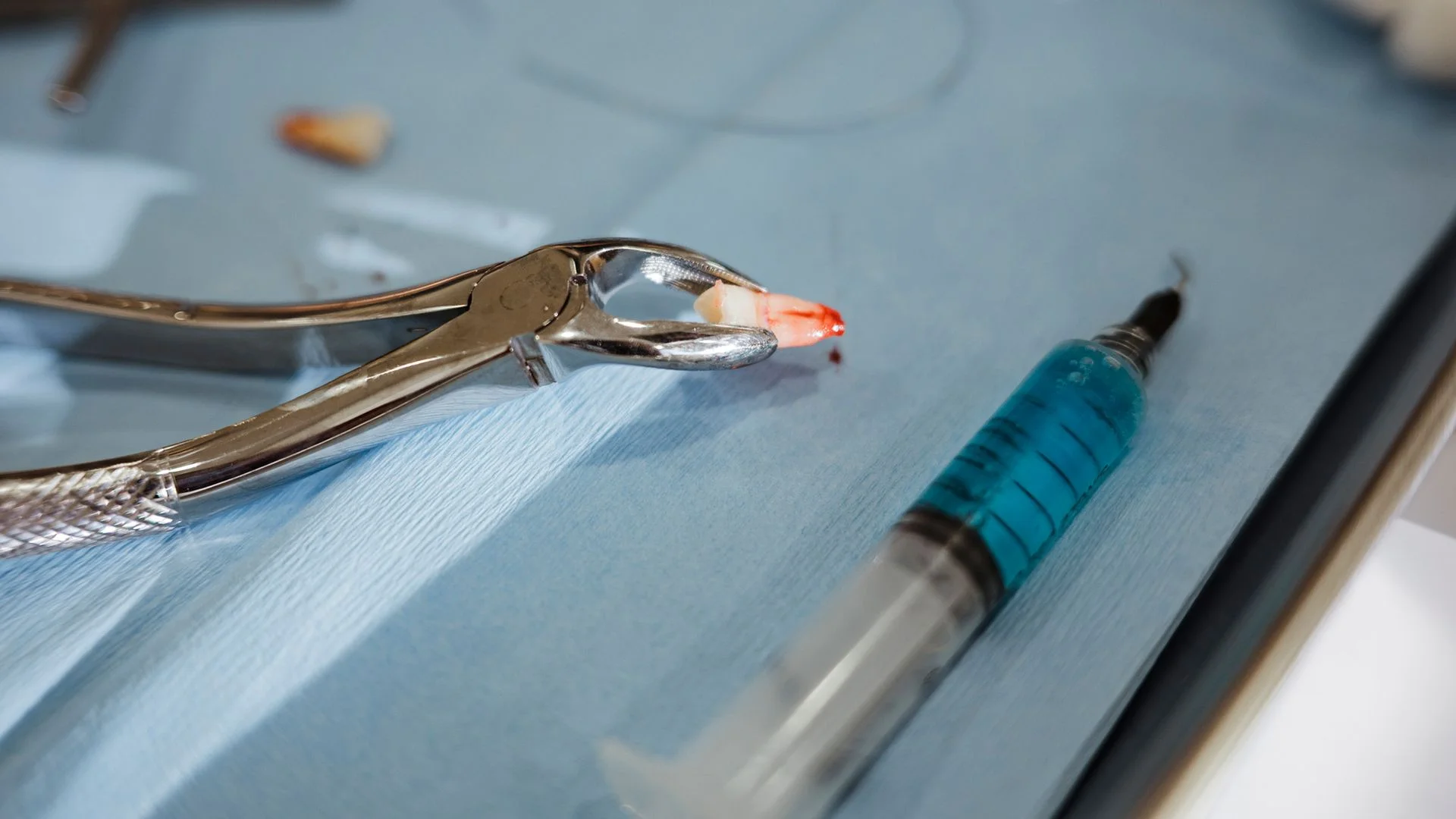 A Rare Case of Ectopic Tooth Emerges in Teen's Eyelid